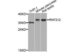 Western blot analysis of extract of various cells, using RNF212 antibody. (RNF212 antibody)
