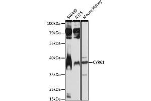 Western blot analysis of extracts of various cell lines, using CYR61 antibody (ABIN1872182) at 1:1000 dilution.