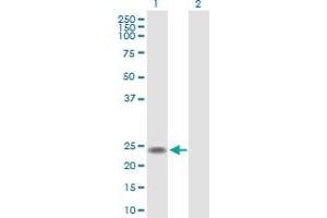 Western Blot analysis of U2AF1L4 expression in transfected 293T cell line by U2AF1L4 MaxPab polyclonal antibody. (Splicing factor U2AF 26 kDa subunit (U2AF1L4) (AA 1-202) antibody)