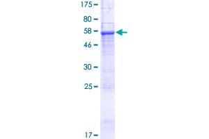 SEC22C Protein (AA 1-303) (GST tag)