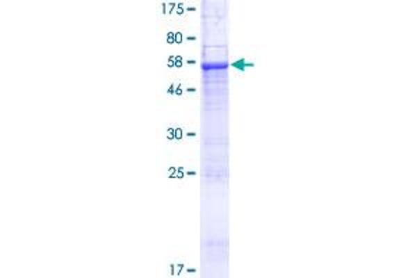 SEC22C Protein (AA 1-303) (GST tag)