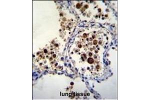 SIGLEC15 Antibody (C-term) (ABIN655450 and ABIN2844979) immunohistochemistry analysis in formalin fixed and paraffin embedded human lung tissue followed by peroxidase conjugation of the secondary antibody and DAB staining. (SIGLEC15 antibody  (C-Term))