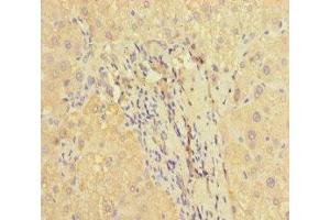 Immunohistochemistry of paraffin-embedded human liver tissue using ABIN7166464 at dilution of 1:100 (PAR1 antibody  (AA 42-102))