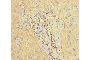 Immunohistochemistry of paraffin-embedded human liver tissue using ABIN7166464 at dilution of 1:100 (PAR1 antibody  (AA 42-102))