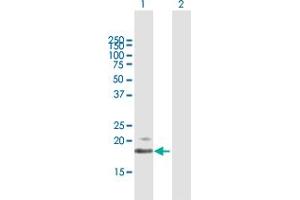 Western Blot analysis of IFNB1 expression in transfected 293T cell line by IFNB1 MaxPab polyclonal antibody. (IFNB1 antibody  (AA 1-187))
