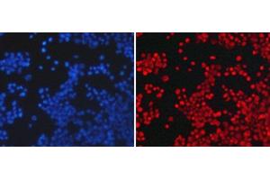 Immunofluorescence analysis of 293T cells using Asymmetric DiMethyl-Histone H3-R26 Polyclonal Antibody (Histone 3 antibody  (H3R26me2a))