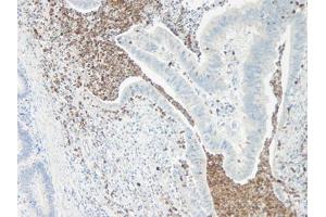 Image no. 1 for anti-Interleukin 5 (IL5) antibody (ABIN465636) (IL-5 antibody)