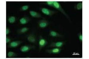 Immunostaining analysis in HeLa cells. (ID1 antibody)