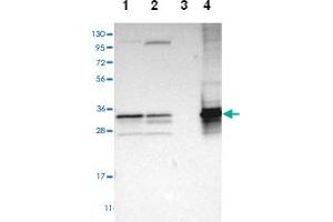 Western blot analysis of Lane 1: Human cell line RT-4, Lane 2: Human cell line U-251MG sp, Lane 3: Human plasma (IgG/HSA depleted), Lane 4: Human liver tissue with TST polyclonal antibody  at 1:100-1:250 dilution.
