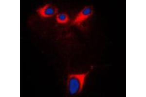 Immunofluorescent analysis of Cytochrome P450 2E1 staining in NIH3T3 cells. (CYP2E1 antibody  (C-Term))