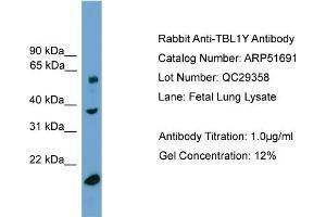 WB Suggested Anti-TBL1Y  Antibody Titration: 0. (TBL1Y antibody  (Middle Region))