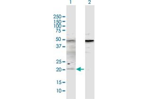 ATOH7 anticorps  (AA 1-152)