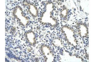 Rabbit Anti-ZNF274 antibody         Paraffin Embedded Tissue:  Human Lung    cell Cellular Data:  alveolar cell    Antibody Concentration:  4. (ZNF274 antibody  (Middle Region))