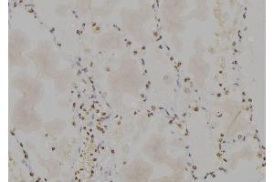 ABIN6277166 at 1/100 staining Human lung tissue by IHC-P. (PPP1CA antibody  (C-Term))
