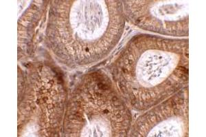 Immunohistochemistry of SPINK2 in mouse testis tissue with SPINK2 antibody at 2.