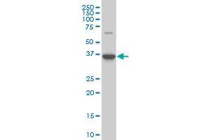 BOLL monoclonal antibody (M14), clone 1G3 Western Blot analysis of BOLL expression in Y-79 . (BOLL antibody  (AA 80-176))