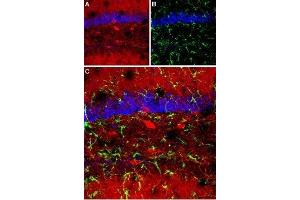 Expression of GABRA1 in mouse hippocampusImmunohistochemical staining of mouse hippocampus using Anti-GABA(A) α1 Receptor (extracellular) Antibody (ABIN7043183, ABIN7044295 and ABIN7044296).