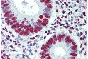 Human Uterus: Formalin-Fixed, Paraffin-Embedded (FFPE) (GRB2 antibody  (AA 156-217))
