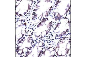 HRASLS5 Antibody (Center) ((ABIN657802 and ABIN2846775))immunohistochemistry analysis in formalin fixed and paraffin embedded human rectum tissue followed by peroxidase conjugation of the secondary antibody and DAB staining. (HRASLS5 antibody  (AA 100-129))