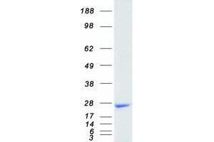 Validation with Western Blot (HRAS Protein (Transcript Variant 1) (Myc-DYKDDDDK Tag))