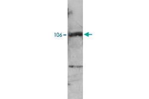 Western blot analysis of extracts from NB4 cells using PML polyclonal antibody .