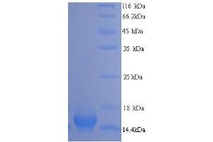 SDS-PAGE (SDS) image for phospholipase A2, Group V (PLA2G5) (AA 21-138) protein (His tag) (ABIN5713736)