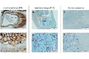 Immunohistochemical staining of PlGF in paraffin-embedded mouse placenta embryo (a and b) showing intense cytoplasmic staining in mouse placenta at E9.
