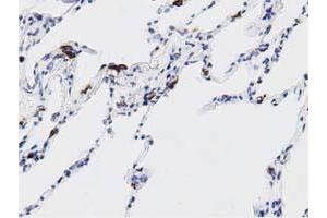 Immunohistochemistry (IHC) image for anti-DnaJ (Hsp40) Homolog, Subfamily A, Member 2 (DNAJA2) antibody (ABIN1497859)