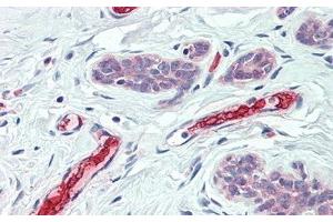 Detection of HBb in Human Breast Tissue using Polyclonal Antibody to Hemoglobin Beta (HBb) (Hemoglobin Subunit beta antibody  (AA 1-147))