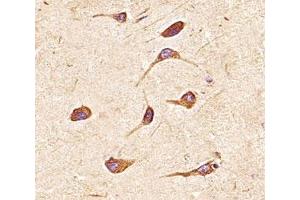 Immunohistochemistry (IHC) image for anti-Fibroblast Growth Factor Receptor 2 (FGFR2) (AA 7-37) antibody (ABIN3030951)