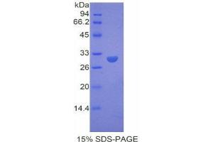 SDS-PAGE (SDS) image for Dystrophin (DMD) (AA 3059-3314) protein (His tag) (ABIN2120974)