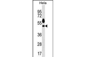 Mouse Sgk1 Antibody (C-term) (ABIN1537130 and ABIN2850307) western blot analysis in Hela cell line lysates (35 μg/lane). (SGK1 antibody  (C-Term))