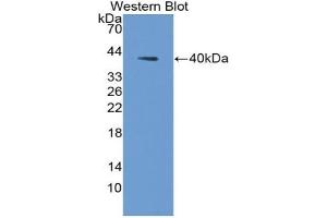 Detection of Recombinant AQP2, Human using Polyclonal Antibody to Aquaporin 2, Collecting Duct (AQP2) (AQP2 antibody  (AA 177-271))