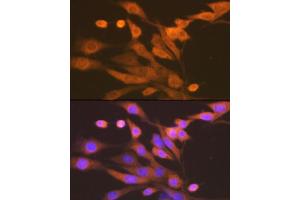 Immunofluorescence analysis of NIH-3T3 cells using Xanthine Oxidase (XDH) (XDH) Rabbit mAb (ABIN7271408) at dilution of 1:100 (40x lens). (XDH antibody)