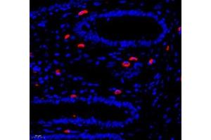 Immunofluorescence of paraffin embedded human colon using Annexin-A8 (ABIN7073071) at dilution of 1: 3866 (400x lens) (Annexin VIII antibody)