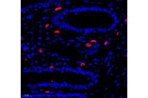 Immunofluorescence of paraffin embedded human colon using Annexin-A8 (ABIN7073071) at dilution of 1: 3866 (400x lens)
