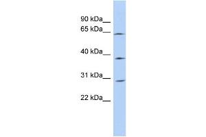 WB Suggested Anti-CCDC54 Antibody Titration: 0. (CCDC54 antibody  (N-Term))