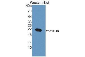 Figure. (ACD antibody  (AA 21-175))