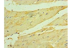 Immunohistochemistry of paraffin-embedded human skeletal muscle tissue using ABIN7154912 at dilution of 1:100 (HSPB2 antibody  (AA 1-182))