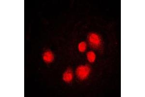 Immunofluorescent analysis of GADD153 staining in MCF7 cells. (DDIT3 antibody  (Center))