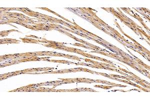 Immunohistochemistry (IHC) image for anti-Caveolin 1, Caveolae Protein, 22kDa (CAV1) (AA 2-104) antibody (ABIN7431320)