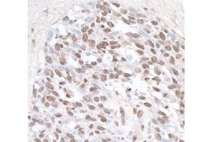 Immunohistochemistry (IHC) image for anti-Zinc Fingers and Homeoboxes 1 (ZHX1) (AA 1-50) antibody (ABIN7454598)