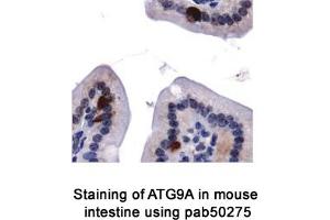 Image no. 2 for anti-ATG9 Autophagy Related 9 Homolog A (S. Cerevisiae) (ATG9A) (AA 750-839), (C-Term) antibody (ABIN363584) (ATG9A antibody  (C-Term))