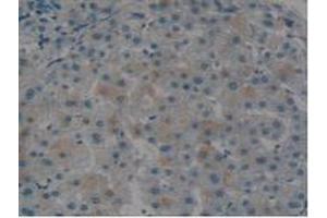 IHC-P analysis of Human Liver Tissue, with DAB staining. (Tissue factor antibody  (AA 34-251))