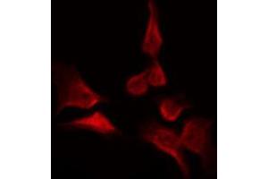 ABIN6269050 staining 293 by IF/ICC. (IKK alpha antibody  (N-Term))