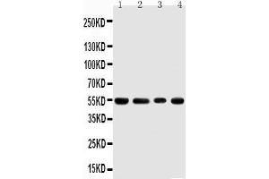 Anti-TRAF4 antibody, Western blotting Lane 1: Rat Thymus Tissue Lysate Lane 2: HELA Cell Lysate Lane 3: JURKAT Cell Lysate Lane 4: HEPA Cell Lysate (TRAF4 antibody  (C-Term))