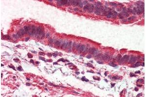 Lung, respiratory epithelium, Human: Formalin-Fixed, Paraffin-Embedded (FFPE) (ADGRV1 / GPR98 antibody  (Internal Region))
