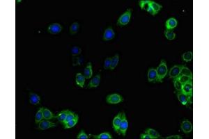 Immunofluorescent analysis of HepG2 cells using ABIN7143463 at dilution of 1:100 and Alexa Fluor 488-congugated AffiniPure Goat Anti-Rabbit IgG(H+L) (GGA1 antibody  (AA 1-89))