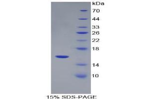SDS-PAGE analysis of Human Renin Protein.