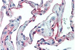 Human Lung (formalin-fixed, paraffin-embedded) stained with ICAM1 antibody ABIN462119 followed by biotinylated anti-mouse IgG secondary antibody ABIN481714, alkaline phosphatase-streptavidin and chromogen. (ICAM1 antibody)